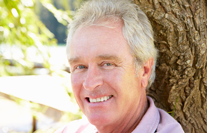 composite-veneers-in-dublin